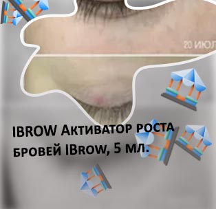 Активатор роста бровей отзывы