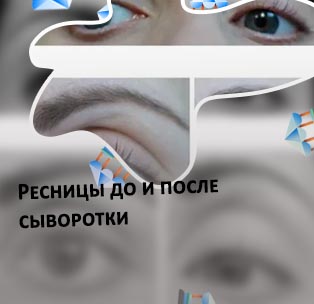 Сыворотка для ресниц до и после